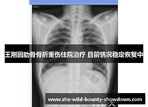 王刚因肋骨骨折重伤住院治疗 目前情况稳定恢复中